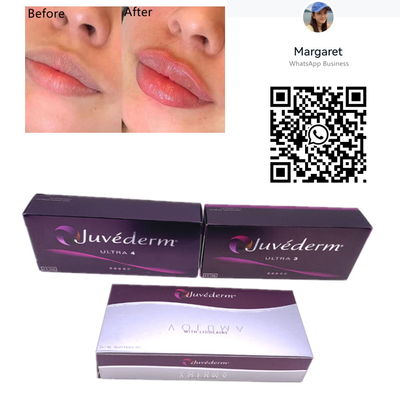 A cruz cutânea das agulhas da seringa do enchimento 2x1ml de Juvederm ligou a injeção do bordo do gel
