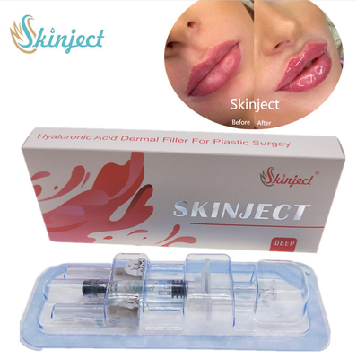 Mordente cutâneo profundo injetável Chin Nasolabial Fold dos enchimentos dos bordos 2ml de Skinject HA
