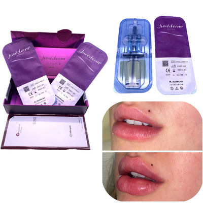O realce do bordo de Juvederm 2x1ml do enchimento do Ha da injeção remove os enrugamentos