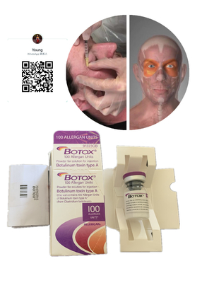 Remoção Allergan  do enrugamento 100 unidades para idade da injeção da face lift a anti