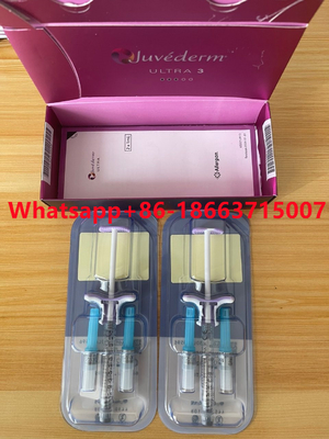 Juvederm Ultra3 Ultra4 que a injeção cutânea do enchimento para o nariz do bordo remove enruga-se
