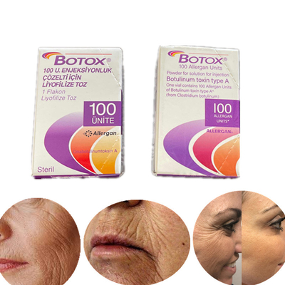 Tipo da edição inglesa uma toxina Botulinum 100 Iu Allergan  para enrugamentos
