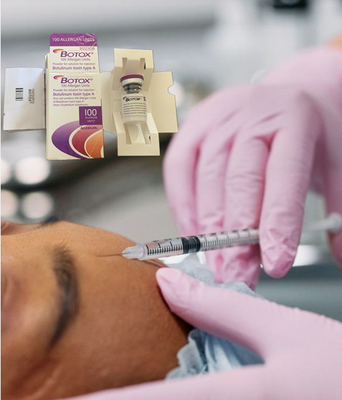 Enrugue a toxina Botulinum  da remoção 100 unidades de Allergan para a injeção da face lift