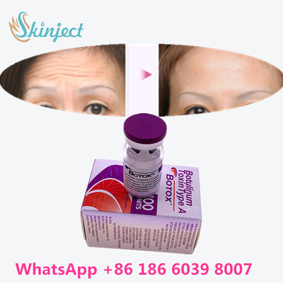 A toxina Botulinum  enruga a remoção 100u Allergan 100 unidades para a injeção da face lift