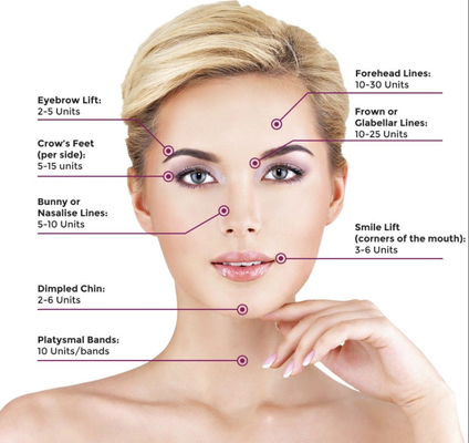 A testa alinha os anti enchimentos cutâneos de Botulax  do enrugamento Botulinum para a face lift