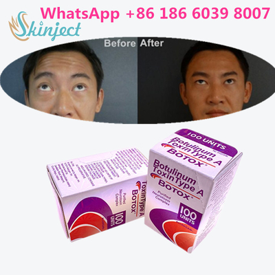 Toxina Botulinum Allergan s 1x100iu para enrugamentos faciais