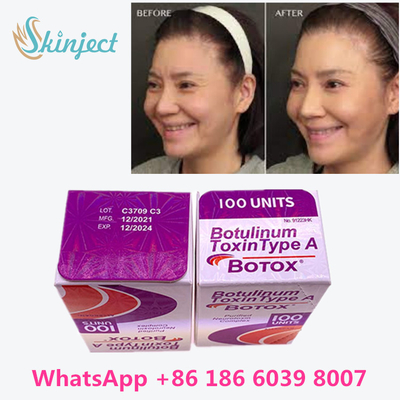 Toxina Botulinum Allergan s 1x100iu para enrugamentos faciais