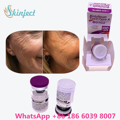 Tubo de ensaio/caixa Botulinum de Allergan  100 Iu 200ui 1 da toxina