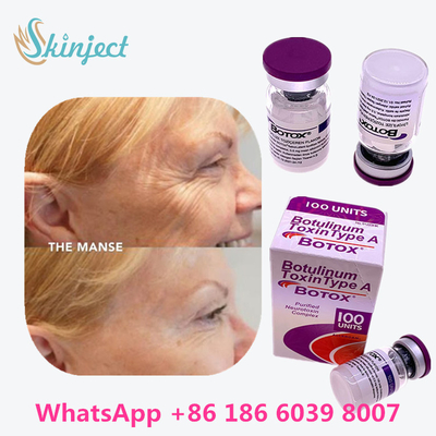 A toxina Botulinum Allergan  datilografa embalagem do tubo de ensaio 100units uma 1/caixa