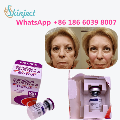 os produtos antienvelhecimento da toxina botulinum allergan datilografam a uma toxina o anti enrugamento
