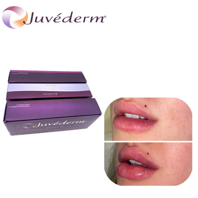 Juvederm Ácido hialurónico alargamento dos lábios preenchimento cutâneo nasal elevação preenchimento dura para o rosto
