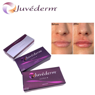 Hyluronic Acid Dermal Filler Premium Juvederm HA Facial Filler Ultra3 Ultra4 Volume Para Rejuvenescimento Facial