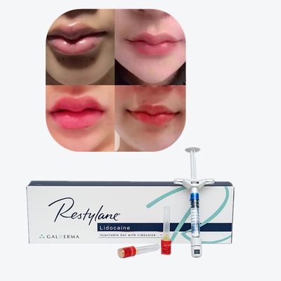 Vital  Perlane Cross Linked Dermal Filler Ácido hialurônico Lyft Fillers Dermicos