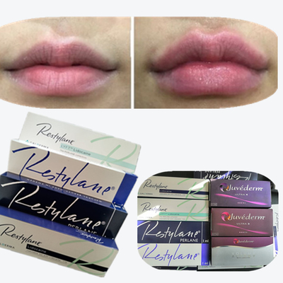 Juvaderm Enchimento de caneta com ácido hialurónico de volume profundo Injetável facial fino