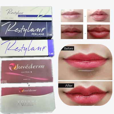 Juvaderm Enchimento de caneta com ácido hialurónico de volume profundo Injetável facial fino