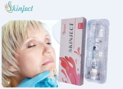 Linha facial / nariz / lábios / mandíbula Hyaluronic Acid Dermal Filler com 2 anos de vida útil