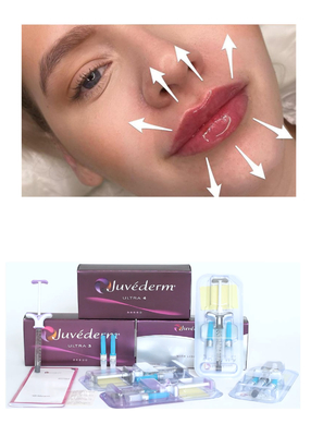 Juvederm' Ácido Hialurónico Enchimento Dermológico Ultra3 Ultra4 Injecção de Volume Para Enchimento de Lábios