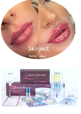 Juvederm Ácido Hialurónico Preenchimento Dermológico Facial Injetável 2*1 ml Embalagem
