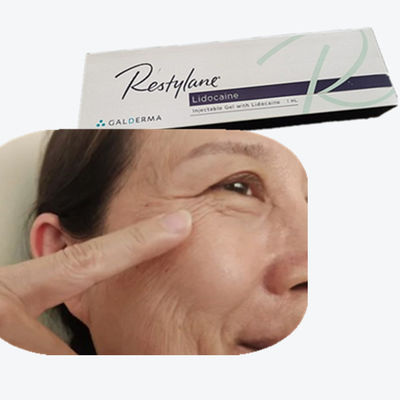 2*1 ml/ caixa Hyaluronic Acid Breast Filler HA Dermal Fillers para linhas da testa