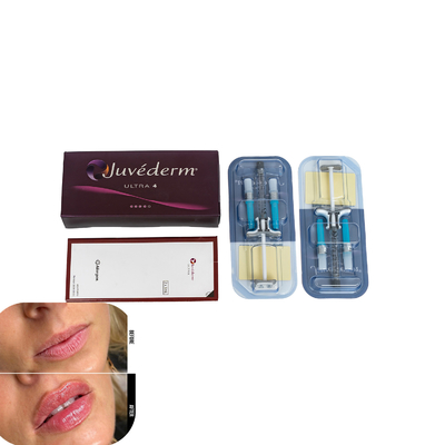 Juvederm Preenchimento Dermológico Para Lábios Injecção Preenchimentos de Ácido Hialurónico