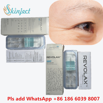 Gel de Hyaluronato de Sódio Médico Ácido Hyalurónico Dermal Revolax Preenchimento Profundo 1 ml Para Injecção em Lábios