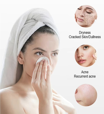 Nova Chegada Black Pearl 10 em 1 Hydra Peel Machine Microdermabrasion Machine Facial Spa Micro-Touch Hydra Skin Care