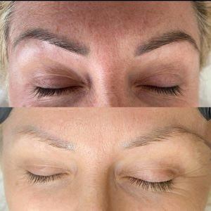 Remoção de sobrancelhas Remoção de cabelo Máquina de beleza a laser Máquina de remoção de tatuagens a laser 810nm