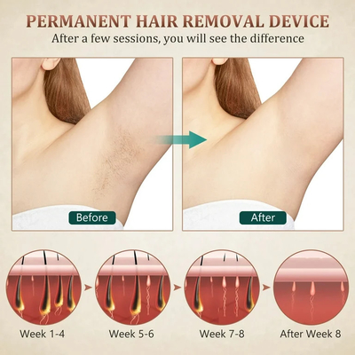 Remoção de sobrancelhas Remoção de cabelo Máquina de beleza a laser Máquina de remoção de tatuagens a laser 810nm