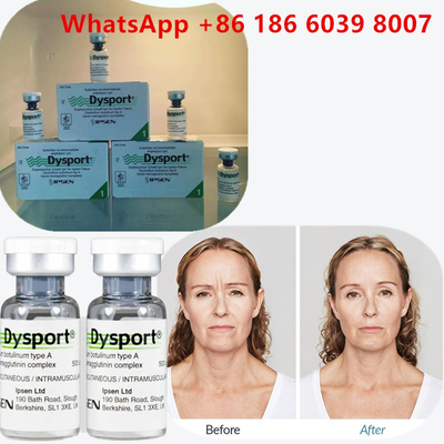 Toxina Botulínica Tipo A 100 Unidades Injecção de  para rugas faciais
