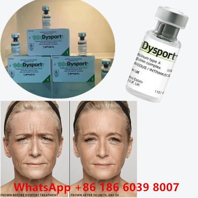 Toxina Botulínica 100 Unidades BTX Injecção Tipo A Utilização cosmética