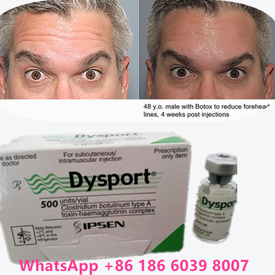 Toxina Botulínica 100 Unidades BTX Injecção Tipo A Utilização cosmética