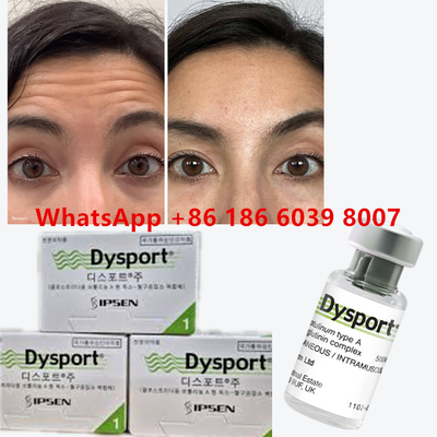 Toxina Botulínica Dysport 100u Clostridium Botulinum Tipo A