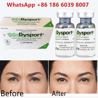 Toxina Botulínica Dysport 100u Clostridium Botulinum Tipo A Para rugas na testa