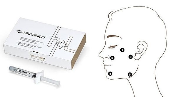 Antienvelhecimento e remoção de rugas Profhilo H L 2 ml Ácido hialurónico Com concentração de 32 mg/ml Ha