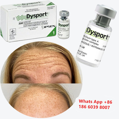 Toxina Botulínica Dysport Anti-rugas Pó liofilizado para elevação do sorriso
