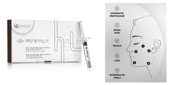 Agulha de levantamento de 5 pontos de aparência natural Profhilo Injectable Dermal Filler