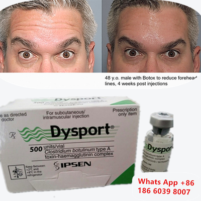 Botulinum Toxin Dysport Botox Clostridium Botulinum Tipo A Para Elevação de Sobrancelhas