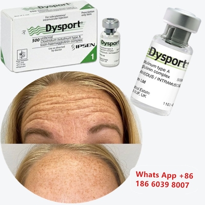 Toxina Botulínica Tipo A Dysport para Rugas na Goteira Lacrimal