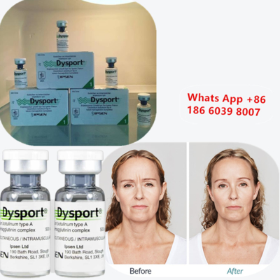 Toxina Botulínica Tipo A Dysport Injecção para Redução de Rugas