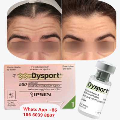 Injeção anti-rugas com toxina botulínica tipo A Dysport para linhas periorais