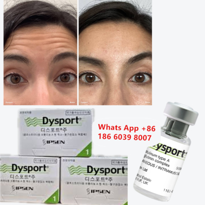 Toxina Botulínica Dysport Anti-rugas Pó liofilizado para emagrecer o rosto