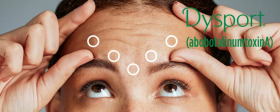 Dysport 500 Para Injecção AbobotulinumtoxinA Botox 500U
