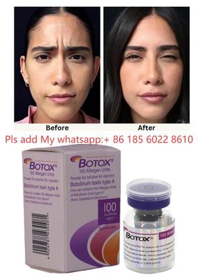 Toxina Botulínica Allergan Botox 100UI Injeção - Reduza os Sinais de Envelhecimento com Allergan