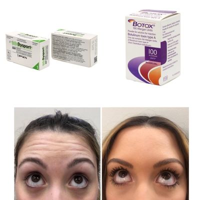 100 Unidades Coreia BTX Toxina Botulínica para Rugas e Linhas Finas