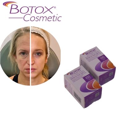 Toxina Botulínica Botox Allergan Tratamento Botox tipo A 100UI Suaviza rugas para o rosto