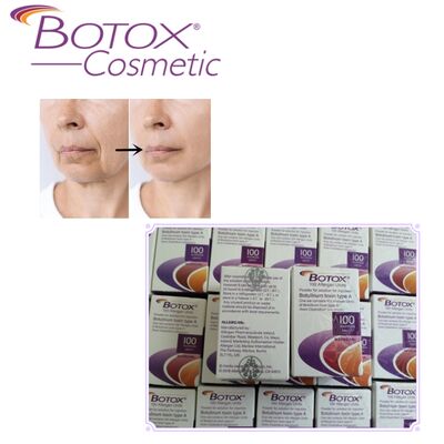 Toxina Botulínica Botox Allergan Tratamento Botox tipo A 100UI Suaviza rugas para o rosto