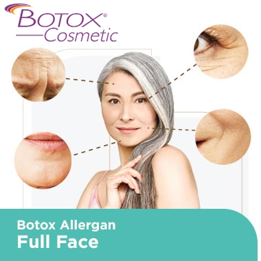 Toxina Allergan 100 u Botulinum Toxin formulação em pó oferecendo suavização de rugas relaxamento muscular e benefícios de contorno facial