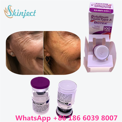 Toxina Botulínica Alergênica Botox em Pó Branco Tratamento Eficaz para Linhas Faciais e Relaxamento Muscular em Medicina