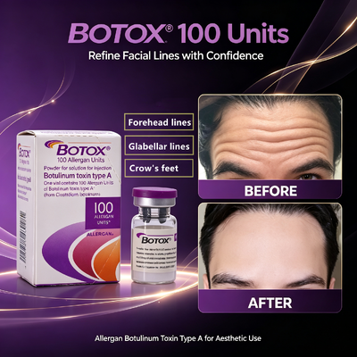 BOTOX 100 unidades Injecção Anti- Rugas Tratamento Facial Estético Alergênico Toxina Botulínica Tipo A