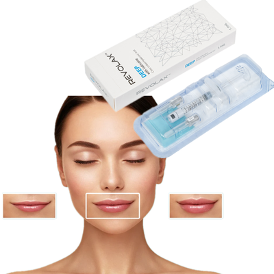 Preenchedor Dérmico Leve OEM 1.1ml Revolax Fine Deep Sub-Q para Linhas Finas e Rejuvenescimento Sutil da Pele